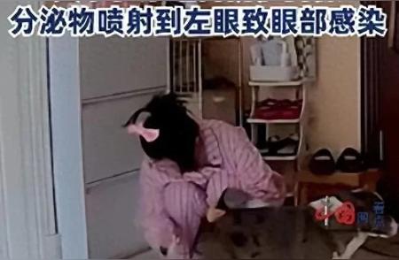 北京女子挤宠物狗肛门腺引发感染，医生揭示罕见案例